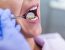 Cases of Dental Implant Nerve Injury Increase